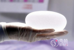 长春铭医整形隆胸好不好?贵不贵?