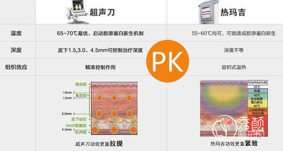 上海九院超声提拉和热玛吉哪个除皱面部提升果好