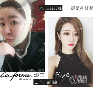 青岛亚美妍整形美容诊所全新整形价格表一览