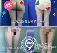 <b>上海九院曹卫刚抽脂怎么样</b>