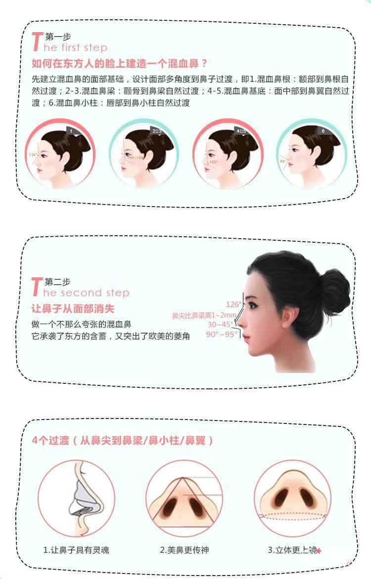 北京沃尔赵丹隆鼻怎么样，有没有失败案例