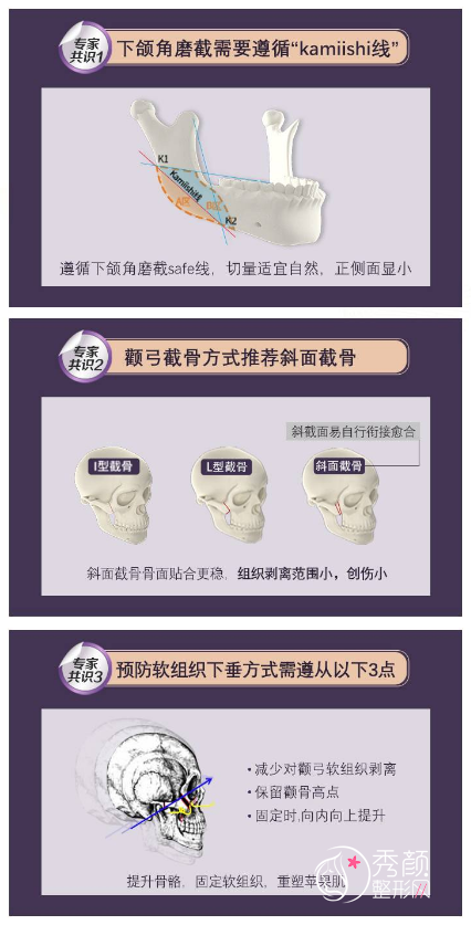 重庆华美潘宝华磨骨怎么样,有没有失败案例?