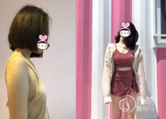 广州隆胸哪个医生好,冯传波和郝永生隆胸怎么样？