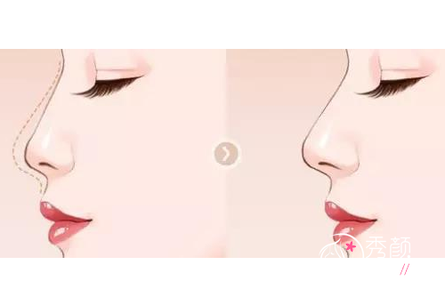 北京八大处哪个医生做鼻子技术好,果自然