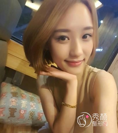 上海伊莱美桂鹏做双眼皮怎么样,有没有失败案例?