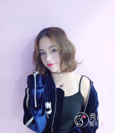 西安雁塔华旗唯美门诊部张沙沙隆鼻怎么样,有没有失败案例?