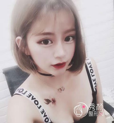 西安雁塔华旗唯美门诊部张沙沙隆鼻怎么样,有没有失败案例?