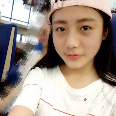 武汉韩辰李相奇做双眼皮怎么样,有没有失败案例？