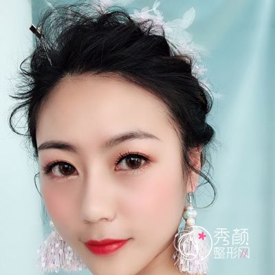 武汉韩辰李相奇做双眼皮怎么样,有没有失败案例？