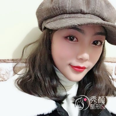 武汉韩辰李相奇做双眼皮怎么样,有没有失败案例？