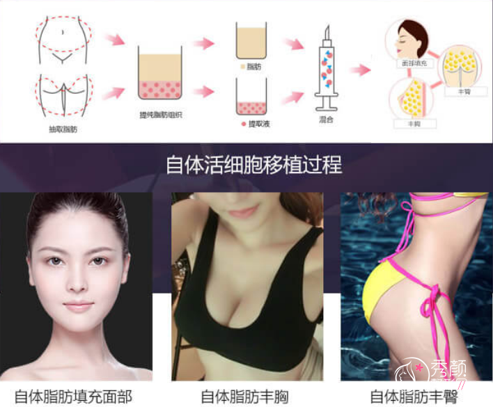 上海美莱袁玉坤整形技术怎么样，口碑好不好/