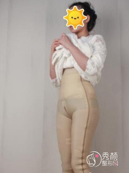 上海伊莱美李旭东吸脂怎么样，有没有失败案例？