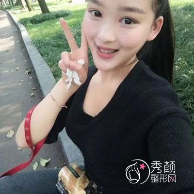 南宁东方医疗美容医院龙海波隆鼻怎么样,有没有失败案例？