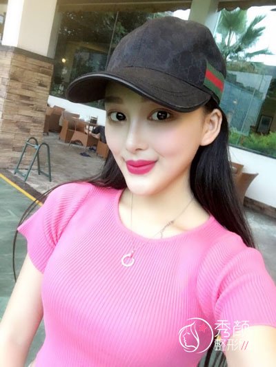 南宁东方医疗美容医院龙海波隆鼻怎么样,有没有失败案例？