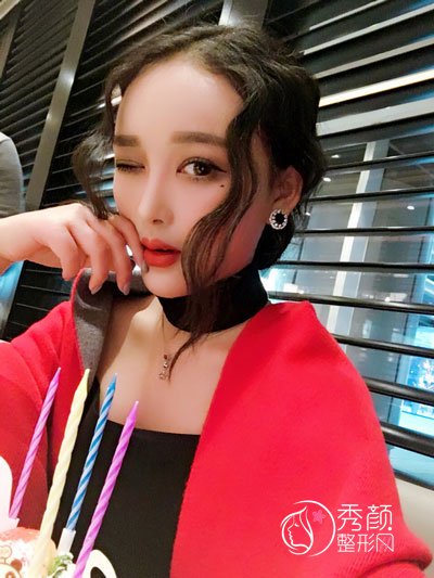 南宁东方医疗美容医院龙海波隆鼻怎么样,有没有失败案例？