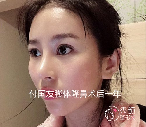 武汉隆鼻哪个医院好，武汉隆鼻医院医生测评。