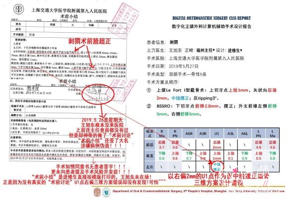 上海第九人民医院整复外科王旭东正颌案例分享。