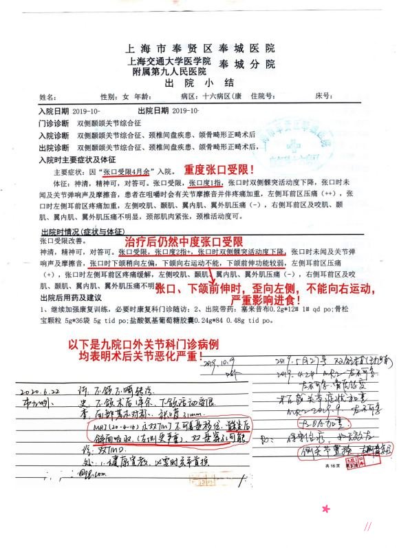 上海第九人民医院整复外科王旭东正颌案例分享。