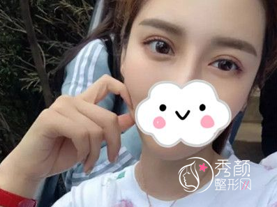 国内热门的双眼皮修复医生优点和缺点分析