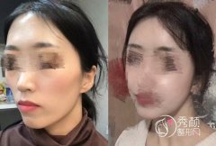 <b>上海首尔丽格和美联臣磨骨哪个好</b>