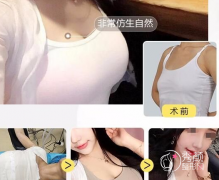 <b>上海隆胸失败修复要多少钱?隆胸修复手术没问题吗?</b>