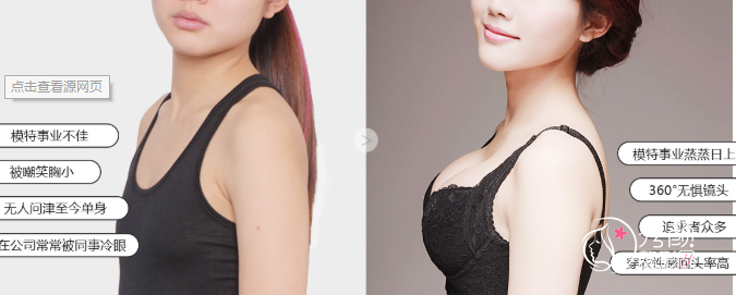 武汉隆胸贵不贵?武汉隆胸手术价格一览表!