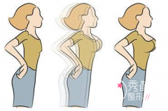 <b>北京隆胸大约多少钱?假体隆胸好还是自体脂肪隆胸好?</b>