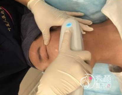 面部超声提拉提升多少钱（附面部提升案例）