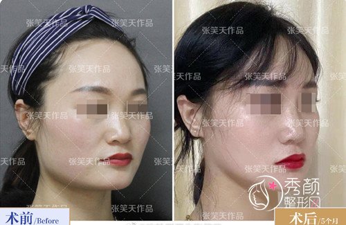 国内十大磨骨专家是谁,张笑天磨骨怎么样?