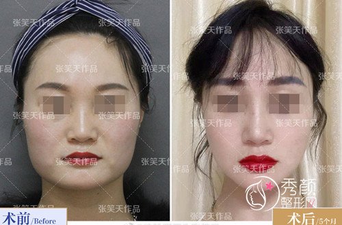 国内十大磨骨专家是谁,张笑天磨骨怎么样?