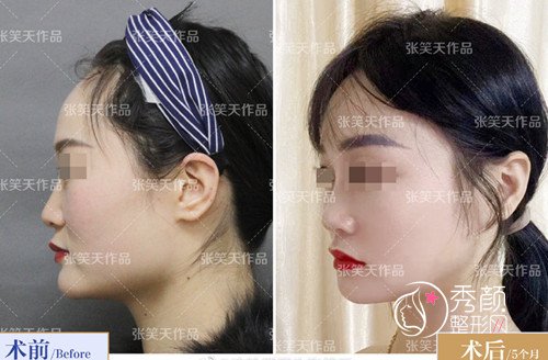 国内十大磨骨专家是谁,张笑天磨骨怎么样?