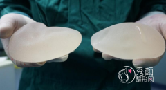 假体隆胸一般多少钱？假体隆胸价格表一览。