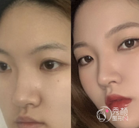 北京隆鼻胡俊峰和刘彦军哪个好 谁没有黑料