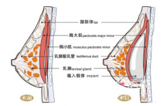 <b>上海隆胸哪家整形机构比较好？</b>