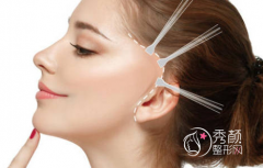 <b>小切口提升和大拉皮手术到底是哪里不一样</b>
