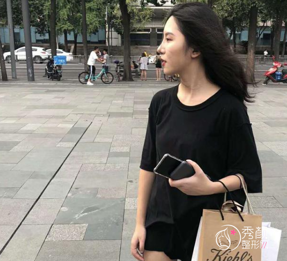 成都成美冯春雨做鼻子怎么样，隆鼻案例来对比。