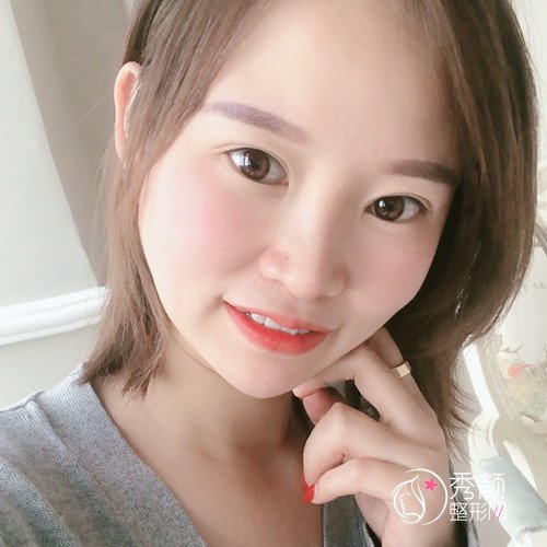 上海圣娅医院鼻王刘春伟隆鼻怎么样？有没有失败案例？