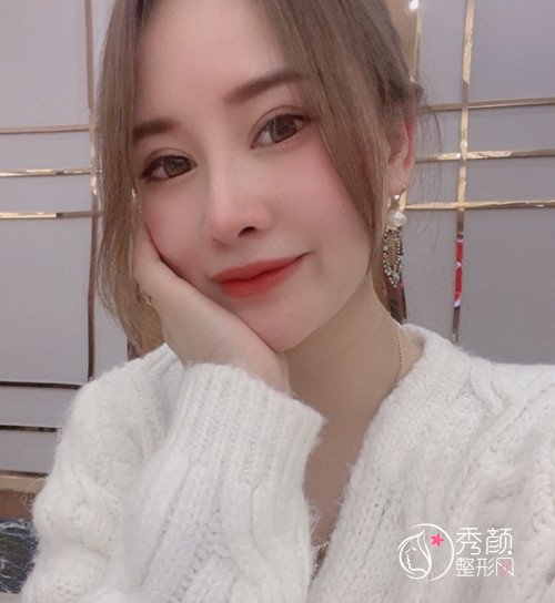 上海圣娅医院鼻王刘春伟隆鼻怎么样？有没有失败案例？