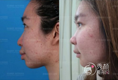 北京八大处杨斌和联合丽格柳春明哪个正颌手术做得好？