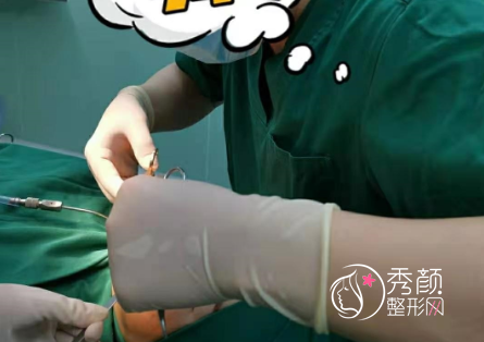 郑州大学第二附属医院李钢磨骨怎么样,有没有失败案例？