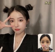 沈阳隆鼻医院医生哪个好，沈阳隆鼻医生攻略【测评】