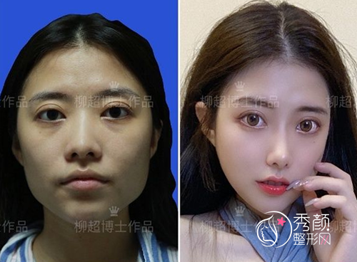 磨骨手术做的好吗，有没有什么黑料？