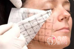 <b>全脸热玛吉五代做一次多少钱</b>