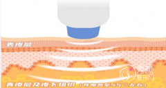 <b>北京做热玛吉除皱大概多少钱</b>