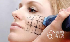 <b>热玛吉除皱一般多少钱?热玛吉除皱果可以维持多久?</b>