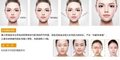 <b>脸大只能磨骨吗？还有什么瘦脸方式？</b>