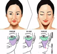 <b>V美骨雕（V美减龄）面部提升多少钱？有副作用吗？</b>