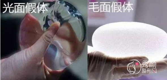 青岛华颜美整形孙好杰院长假体隆胸怎么样？