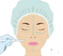 北京哪个医院做脂肪填充全脸好？脂肪填充案例分享。