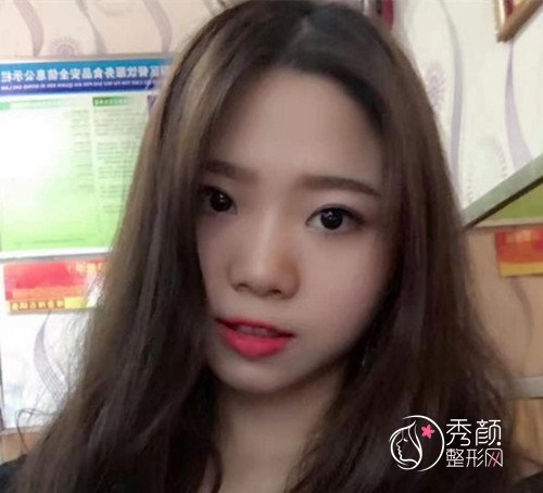 济南韩氏整形美容医院价格明细表一览+附隆鼻案例分享。